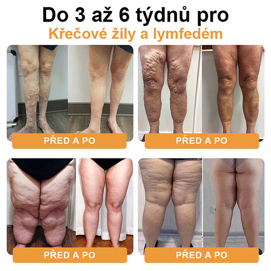 ⌚Detoxikační náramek s ultrazvukovým odbouráváním tuků a dálkovým infračerveným zářením pro vyrovnávání hladiny cukru v krvi - Energy Balance 🔥časově omezená nabídka🔥