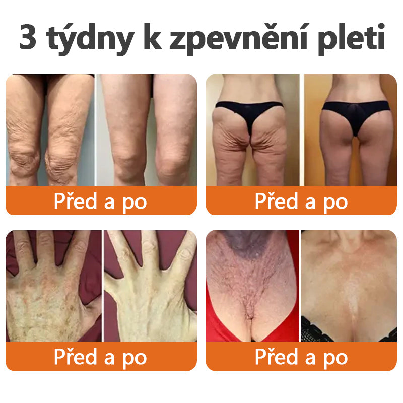 Vyrobeno a odesláno z České republiky✨TLOPA® Zpevňující sérum s botoxem a včelím jedem v tyčince(🔥 POSLEDNÍ DEN SLEVA 70%)💄