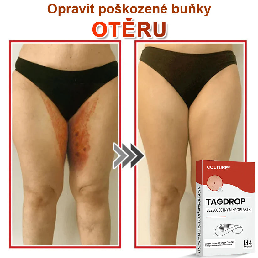 COLTURE® Mikrovpichová botanická náplast na odstranění kožních výrůstků