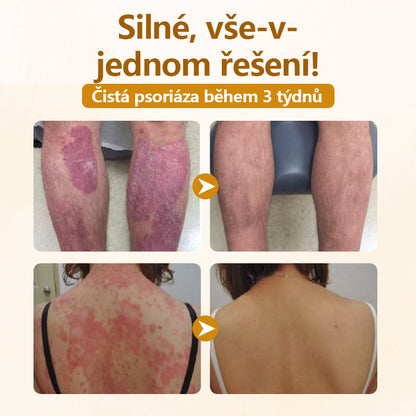 Timilk® Opravný krém s komplexem včelího jedu