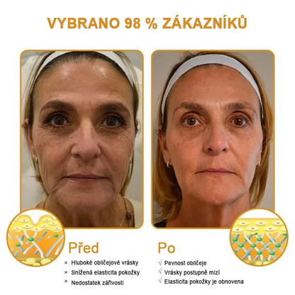 (💟Vyrobeno a odesláno z České republiky✅) Furzero™ Botox včelí jed krém na odstranění vrásek - POSLEDNÍ DEN 70% SLEVA