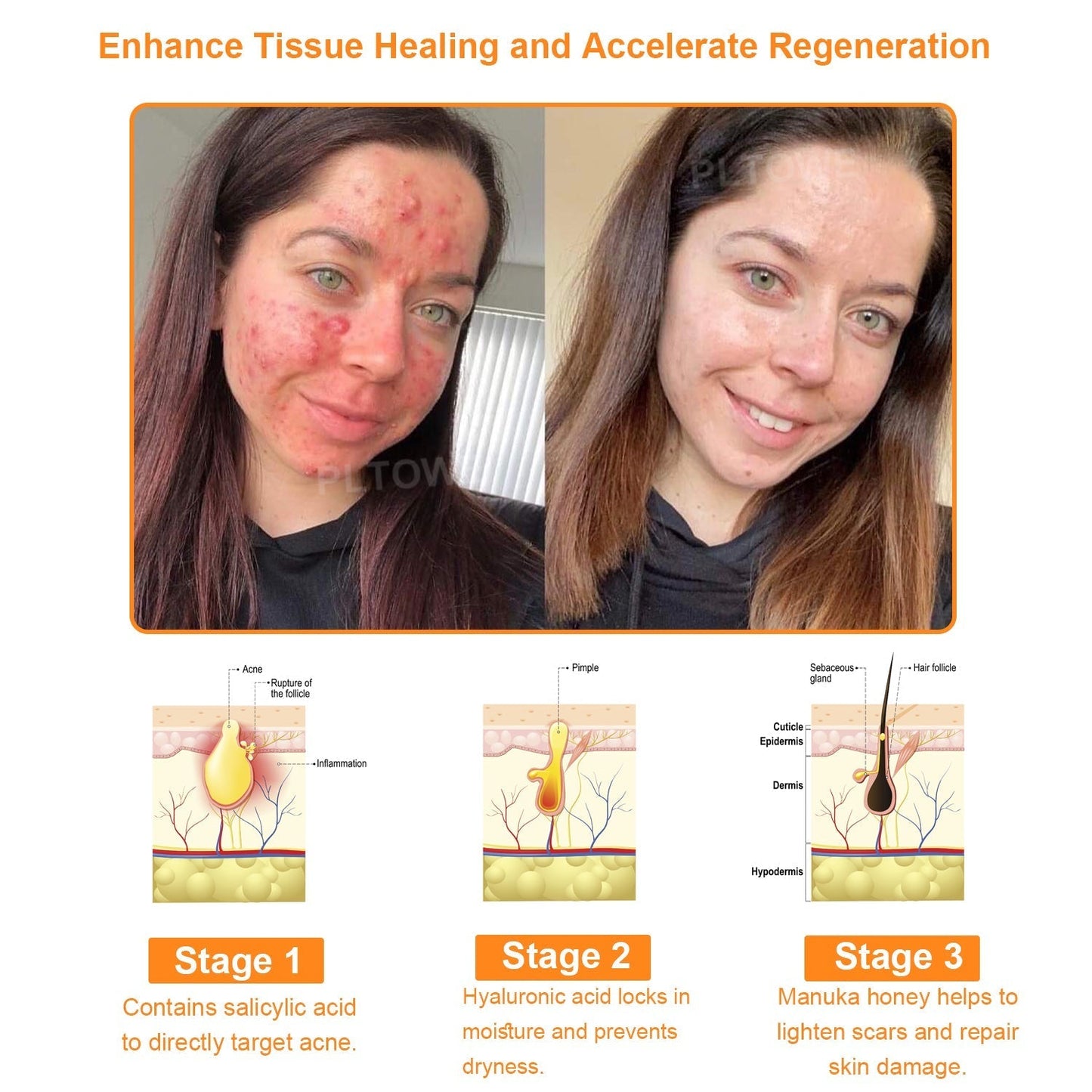 Poslední šance! Uchopte tento šťastný nález za 70% SLEVY!🔥180denní záruka vrácení peněz! Doprava zdarma!