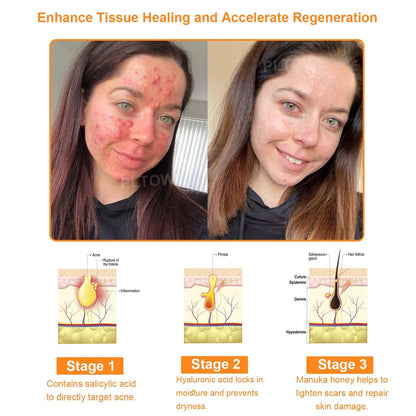 Poslední šance! Uchopte tento šťastný nález za 70% SLEVY!🔥180denní záruka vrácení peněz! Doprava zdarma!