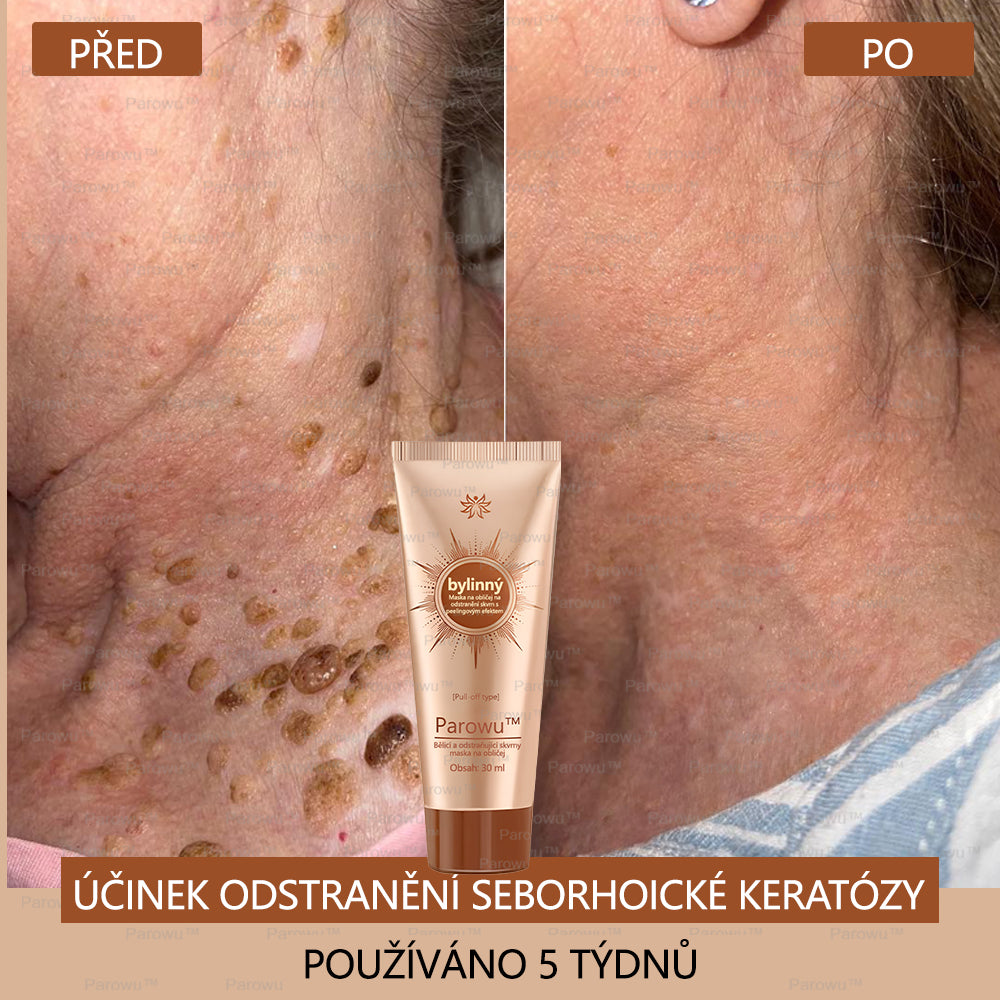 🧡Rowpin® bělící a skvrny odstraňující pleťová maska Vhodná na obličej i tělo - 👩‍⚕️ Přírodní složky trvale odstraňují stařecké skvrny, pihy, sluneční a jaterní skvrny.💥