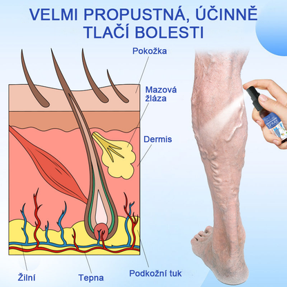 🌱🌠✨Sprej na léčbu křečových žil Veinhealing™🌿
