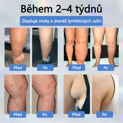 Cvreoz® Černý kmín Edema Detoxikační bylinný krém