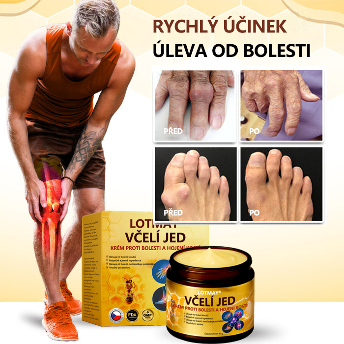 LOTMAY® Krém na hojení kostí proti bolesti se včelím jedem✨✨