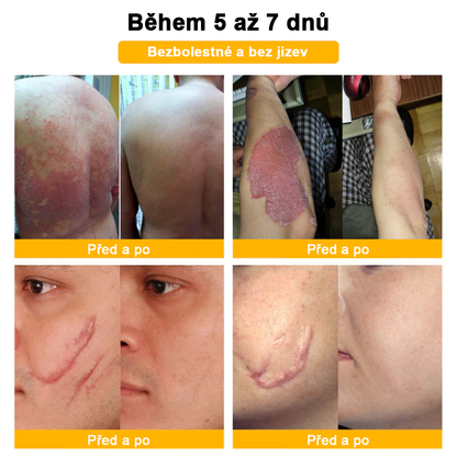 🌱🌠✨AEXZR™ Krém proti bradavicím a krtkům se včelím jedem