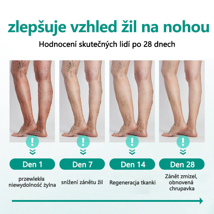 Timilk® Náplast na křečové žíly pro obnovu nohou💥