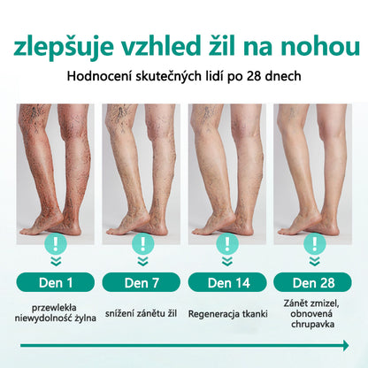 Timilk® Náplast na křečové žíly pro obnovu nohou💥