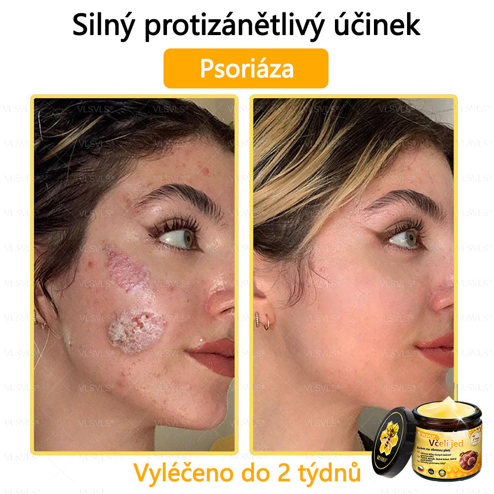 ✅VLSVLS™ Obnovující krém se včelím jedem🐝💥💥