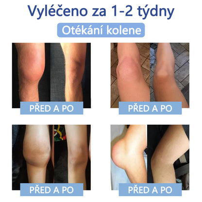 ✅ Schváleno MZČR lékaři | Ourlyard® Hořčíkový krém na úlevu od bolesti kostí a svalů ( Pro artritidu, neuropatii, revmatická onemocnění, svalové křeče, záškuby i sportovní úrazy)