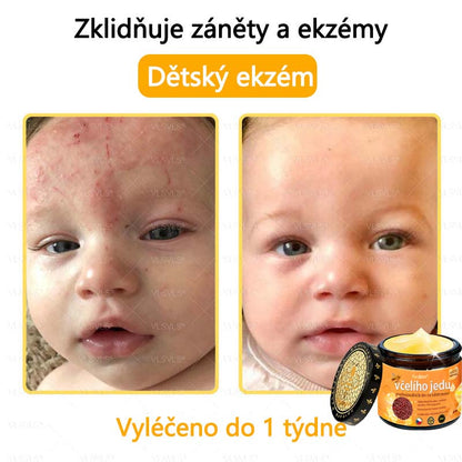 Foulme® Profesionální krém na odstranění včelího jedu🐝