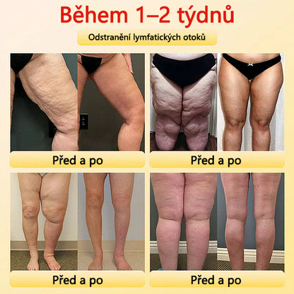 Sfrcord™ Tvarovací šortky z titanových vláken s turmalínem a samovýhřevem 🔥 Časově omezená nabídka – sleva až 80 %