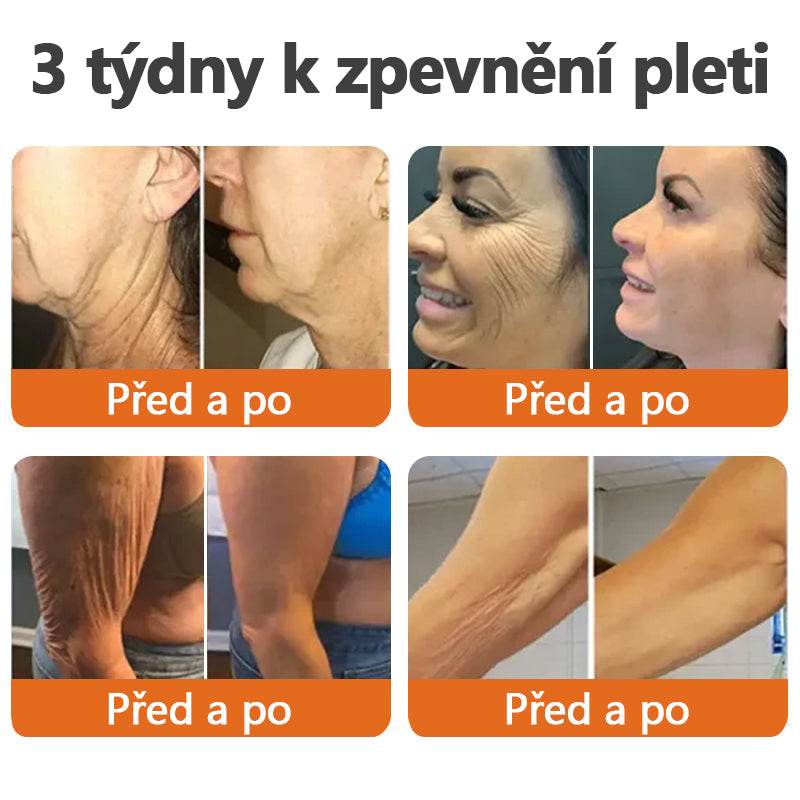 Vyrobeno a odesláno z České republiky✨TLOPA® Zpevňující sérum s botoxem a včelím jedem v tyčince(🔥 POSLEDNÍ DEN SLEVA 70%)💄