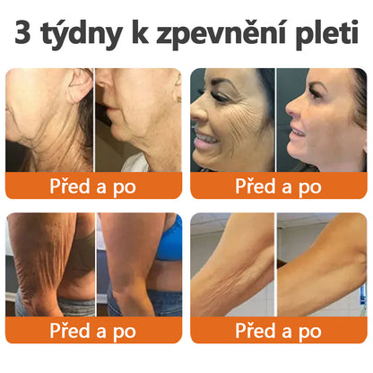 Vyrobeno a odesláno z České republiky✨TLOPA® Zpevňující sérum s botoxem a včelím jedem v tyčince(🔥 POSLEDNÍ DEN SLEVA 70%)💄