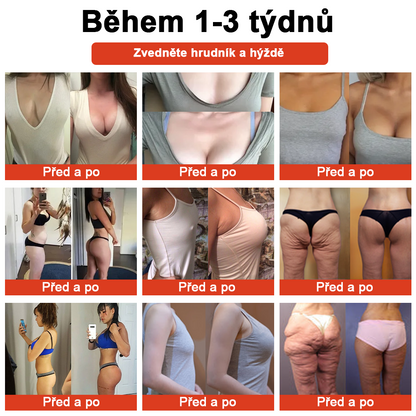 𝗦𝗧𝗗𝗘𝗜™ Zázračný luxusní tělový olej (Časově omezená sleva 80 % - poslední 1 den)🌹🔥