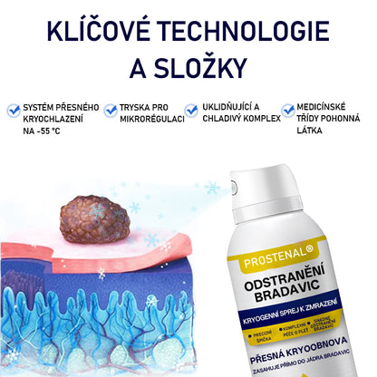 Lékárna Na Poště | Timilk® WartErase Kryogenní sprej