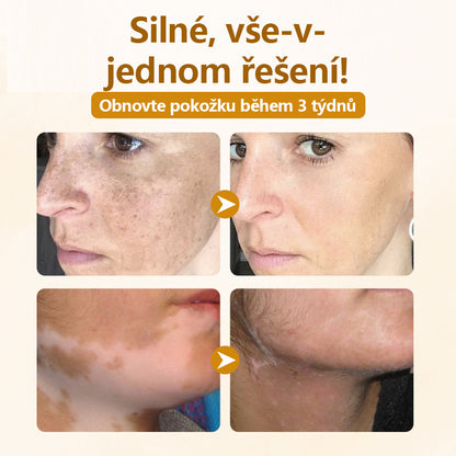 Timilk® Opravný krém s komplexem včelího jedu