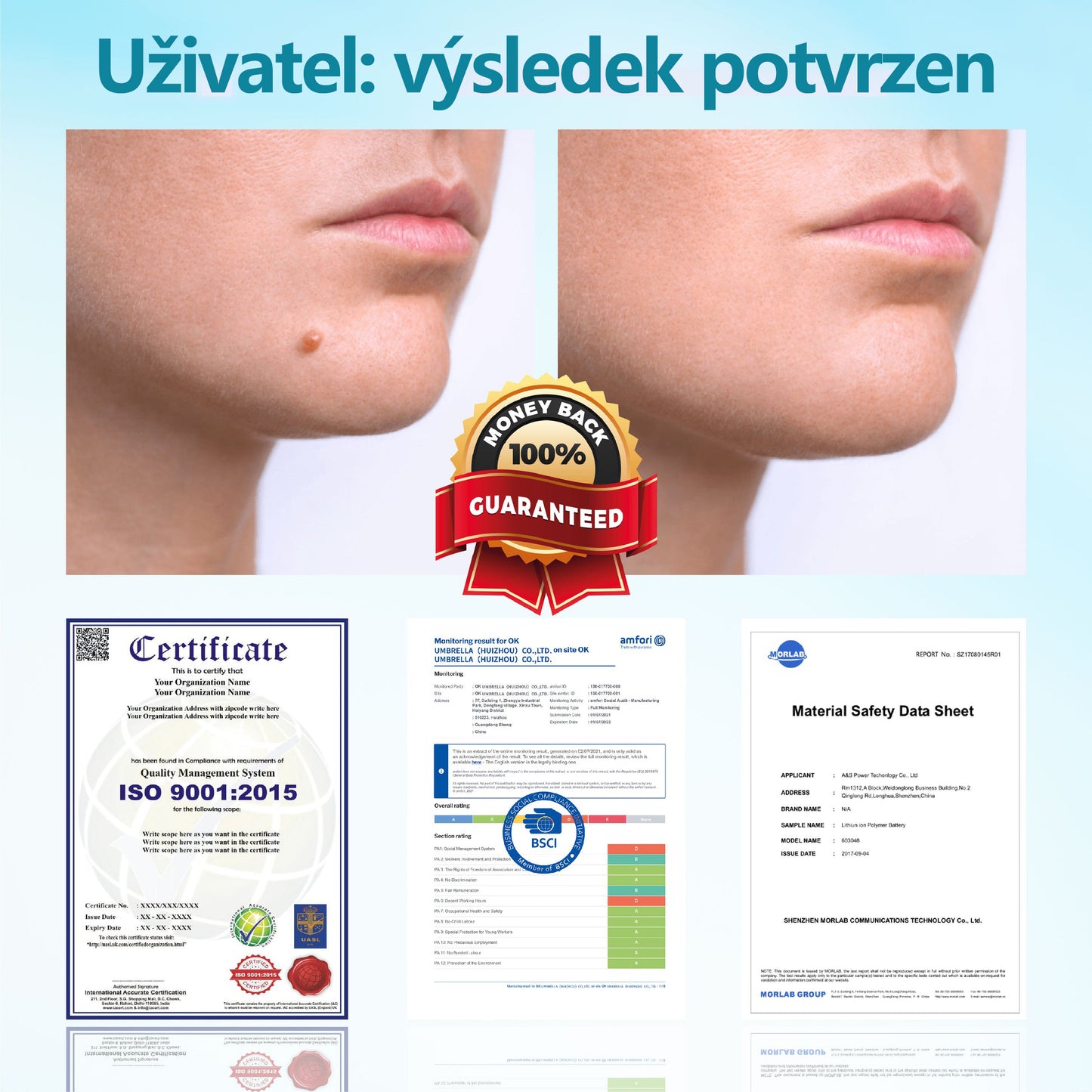 RICPIND® DermaLite Multifunkční laserové pero na odstranění bradavic a obnovu pleti