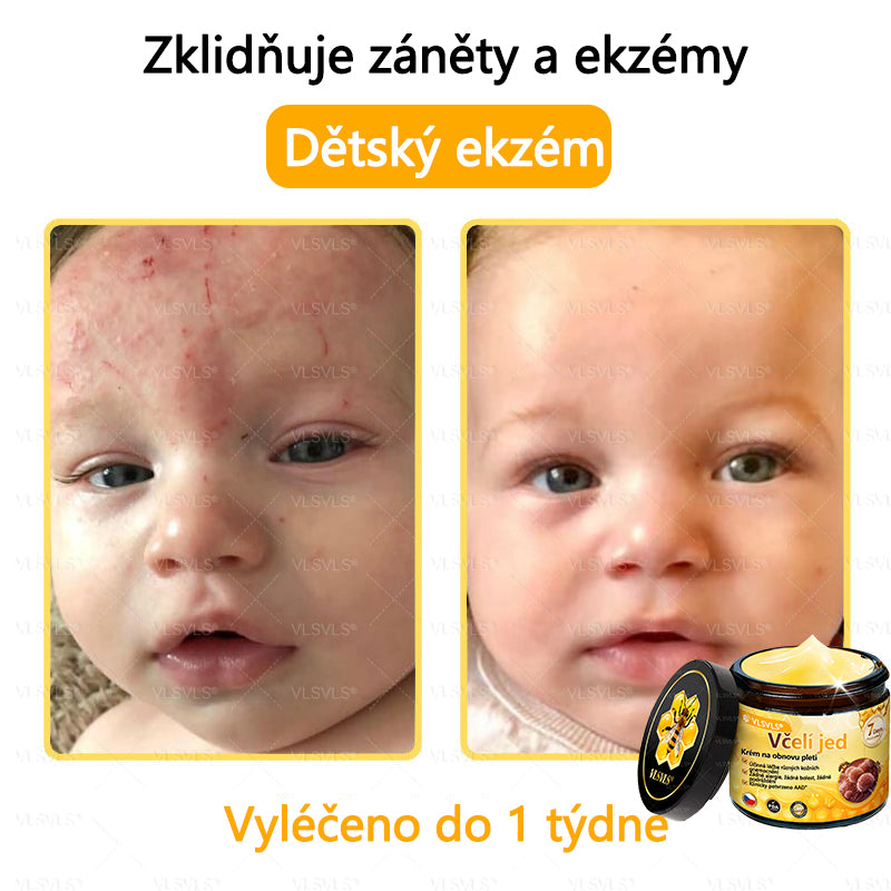 ✅VLSVLS™ Obnovující krém se včelím jedem🐝💥💥