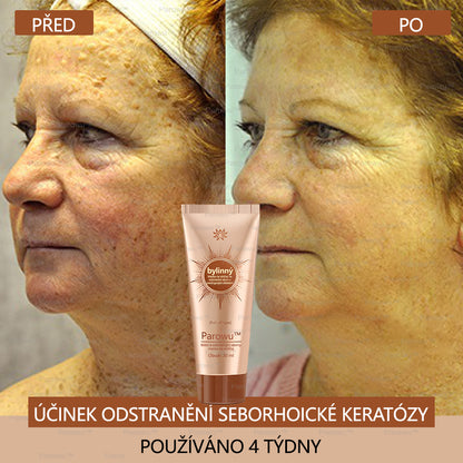 🧡Rowpin® bělící a skvrny odstraňující pleťová maska Vhodná na obličej i tělo - 👩‍⚕️ Přírodní složky trvale odstraňují stařecké skvrny, pihy, sluneční a jaterní skvrny.💥