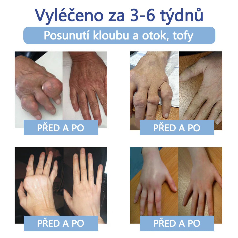 ✅ Schváleno MZČR lékaři | Ourlyard® Hořčíkový krém na úlevu od bolesti kostí a svalů ( Pro artritidu, neuropatii, revmatická onemocnění, svalové křeče, záškuby i sportovní úrazy)