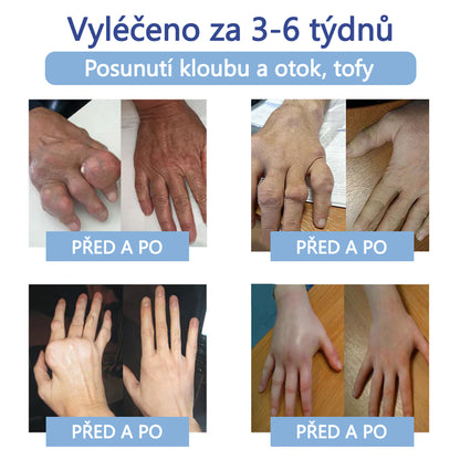 ✅ Schváleno MZČR lékaři | Ourlyard® Hořčíkový krém na úlevu od bolesti kostí a svalů ( Pro artritidu, neuropatii, revmatická onemocnění, svalové křeče, záškuby i sportovní úrazy)