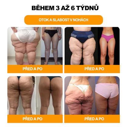 🔥💫 Poslední den na získání slevy 70 %: Aeehfeng®  Včelí jed a 30 bylinek pro detoxikaci nohou a korálky pro tvarování těla  - ✨Doporučeno Evropskou lymfatickou asociací (ELF) ✨🧀