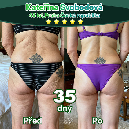 Lékárna Na Poště | Lotmay® Kapky s kmenovými buňkami a kolagenovými peptidy pro vnitřní použití👩‍⚕️ (Zpevnění a lifting povolené pokožky & redukce tvorby vrásek)