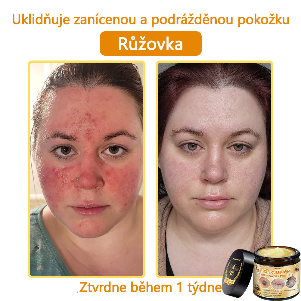 🎇𝐋𝐞𝐧𝐚𝐫𝐨™ Včelí jed všestranný krém, schválený českými dermatology (👩‍ Doporučeno Českou společností pro kožní a pohlavní nemoci CGDV)