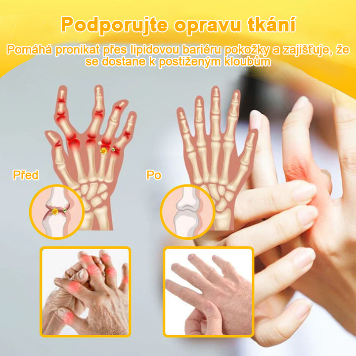 𝑭𝑨𝑻𝑶𝑵𝑮® Krém proti bolesti a hojení kostí ze včelího jedu (Výhradně pro seniory a na doporučení NVOC)🧨