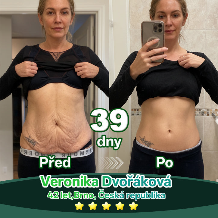 Lékárna Na Poště | Lotmay® Kapky s kmenovými buňkami a kolagenovými peptidy pro vnitřní použití👩‍⚕️ (Zpevnění a lifting povolené pokožky & redukce tvorby vrásek)