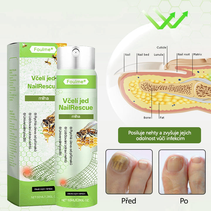Lékárna Na Poště Oficiální obchod | Foulme® NailRescue Včelí jed ve spreji