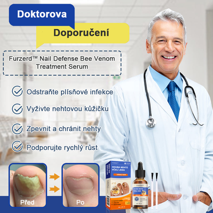 🐝🐝Furzero™ Včelí jed na plíseň nehtů: kompletní řešení plísně nehtů 🌟👣
