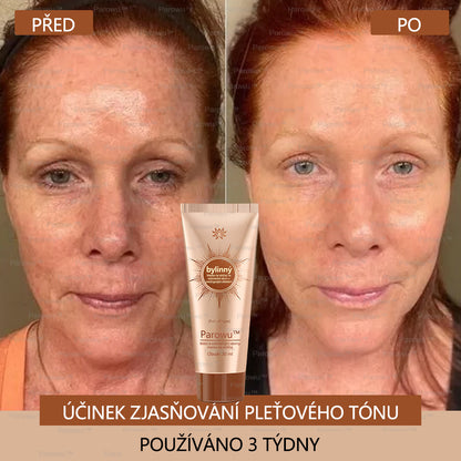 🧡Rowpin® bělící a skvrny odstraňující pleťová maska Vhodná na obličej i tělo - 👩‍⚕️ Přírodní složky trvale odstraňují stařecké skvrny, pihy, sluneční a jaterní skvrny.💥