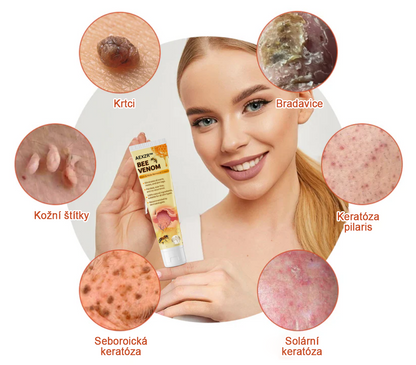🌱🌠✨AEXZR™ Krém proti bradavicím a krtkům se včelím jedem