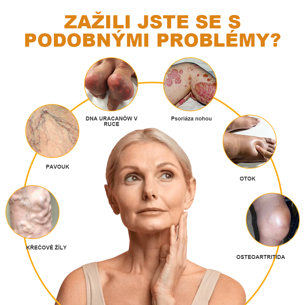 🏆🌈[✨Oficiální značkový obchod✨]Zoencgz™ Krém na léčbu artritidy a křečových žil se včelím jedem（AVLS & ACR DOPORUČUJE）