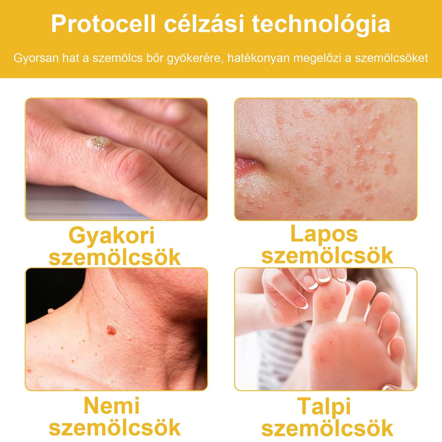 🐝BSWELL® Krém na ošetření včelím jedem👨‍⚕️（MDT ajánlott） 🔥poslední den propagace 80% vypnuto
