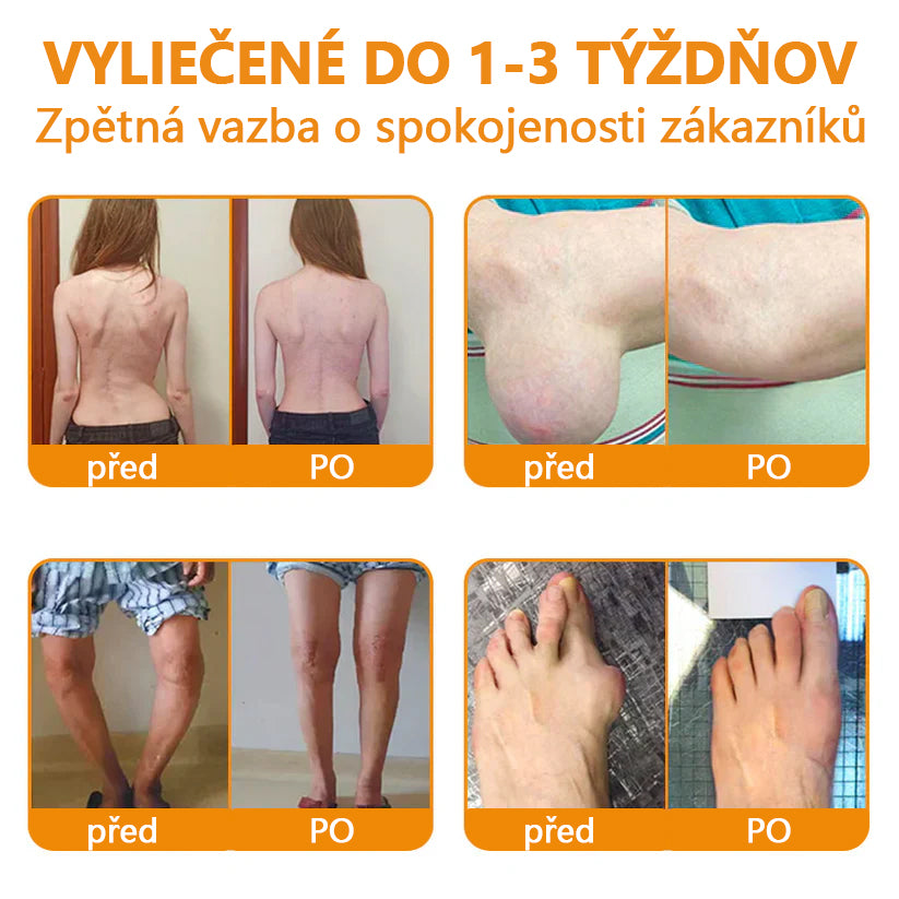 🔥💫Ourlyard™ Hořčíkový olej a včelí jed na hojení kloubů ve spreji👨‍⚕️Cure bolesti kloubů za pouhé 4 týdny, bez zpětného efektu