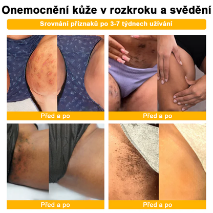 🌱🌠✨AEXZR™ Krém proti bradavicím a krtkům se včelím jedem