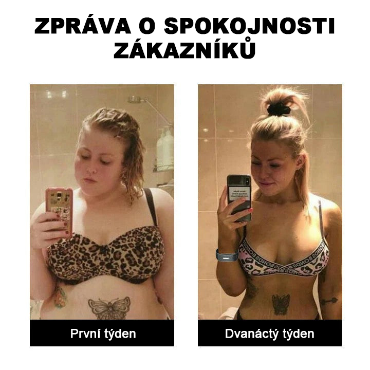 🥇 𝐉𝐎𝐒𝐅𝐈𝐓™ Ultrazvukový náramek pro odstranění celulitidy a detoxikaci organismu
