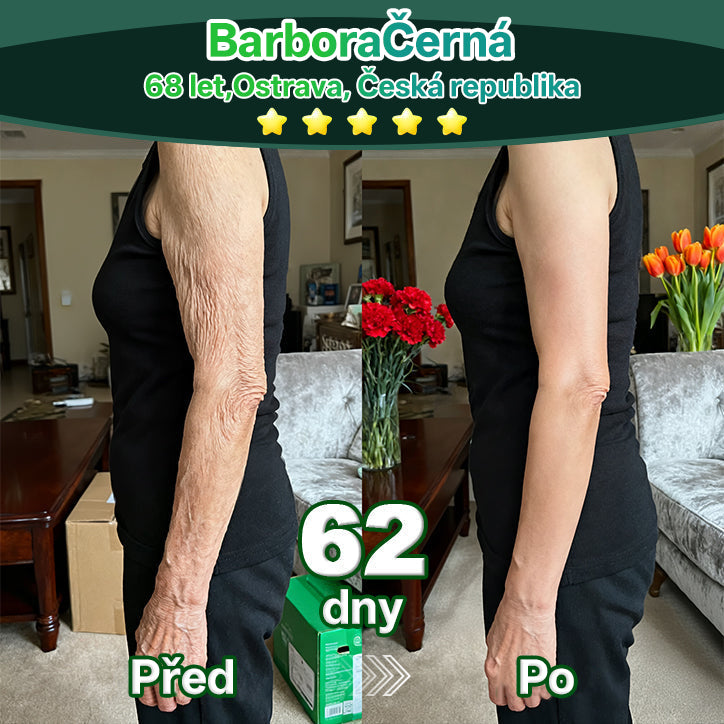 Lékárna Na Poště | Lotmay® Kapky s kmenovými buňkami a kolagenovými peptidy pro vnitřní použití👩‍⚕️ (Zpevnění a lifting povolené pokožky & redukce tvorby vrásek)