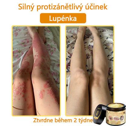 🎇𝐋𝐞𝐧𝐚𝐫𝐨™ Včelí jed všestranný krém, schválený českými dermatology (👩‍ Doporučeno Českou společností pro kožní a pohlavní nemoci CGDV)