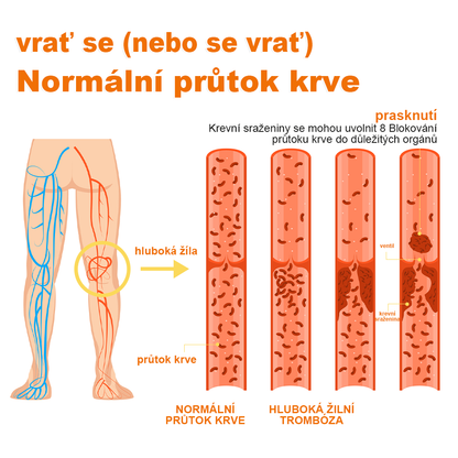 🏆🌈[✨Oficiální značkový obchod✨]Zoencgz™ Krém na léčbu artritidy a křečových žil se včelím jedem（AVLS & ACR DOPORUČUJE）