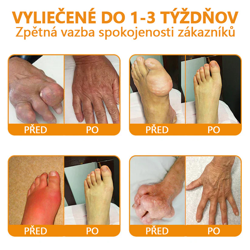 🔥💫Ourlyard™ Hořčíkový olej a včelí jed na hojení kloubů ve spreji👨‍⚕️Cure bolesti kloubů za pouhé 4 týdny, bez zpětného efektu