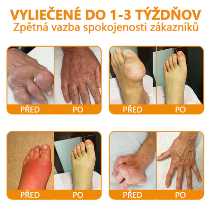 🔥💫Ourlyard™ Hořčíkový olej a včelí jed na hojení kloubů ve spreji👨‍⚕️Cure bolesti kloubů za pouhé 4 týdny, bez zpětného efektu