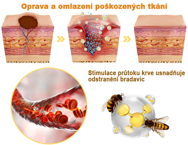 🌱🌠✨AEXZR™ Krém proti bradavicím a krtkům se včelím jedem