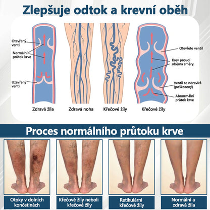 Cvreoz® Černý kmín Edema Detoxikační bylinný krém