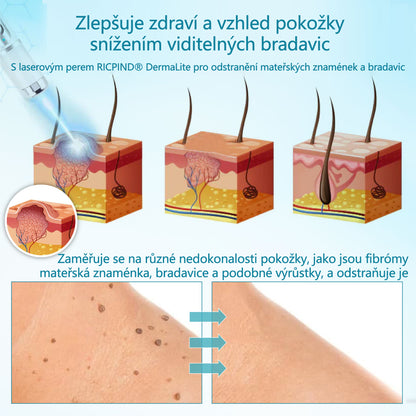 RICPIND® DermaLite Multifunkční laserové pero na odstranění bradavic a obnovu pleti